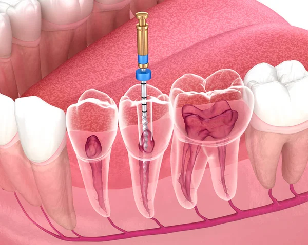 Endodontia